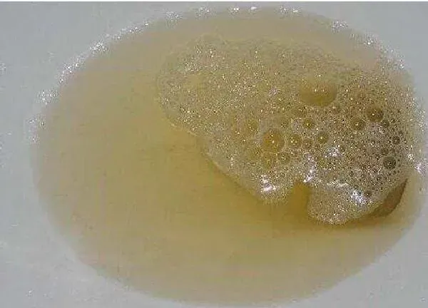 植物浇水|人的尿液可以浇花吗